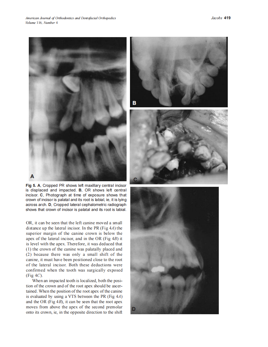 1999_116_4_415_423_Jacobs_by_OrTHoTaMiNe.pdf 第5页