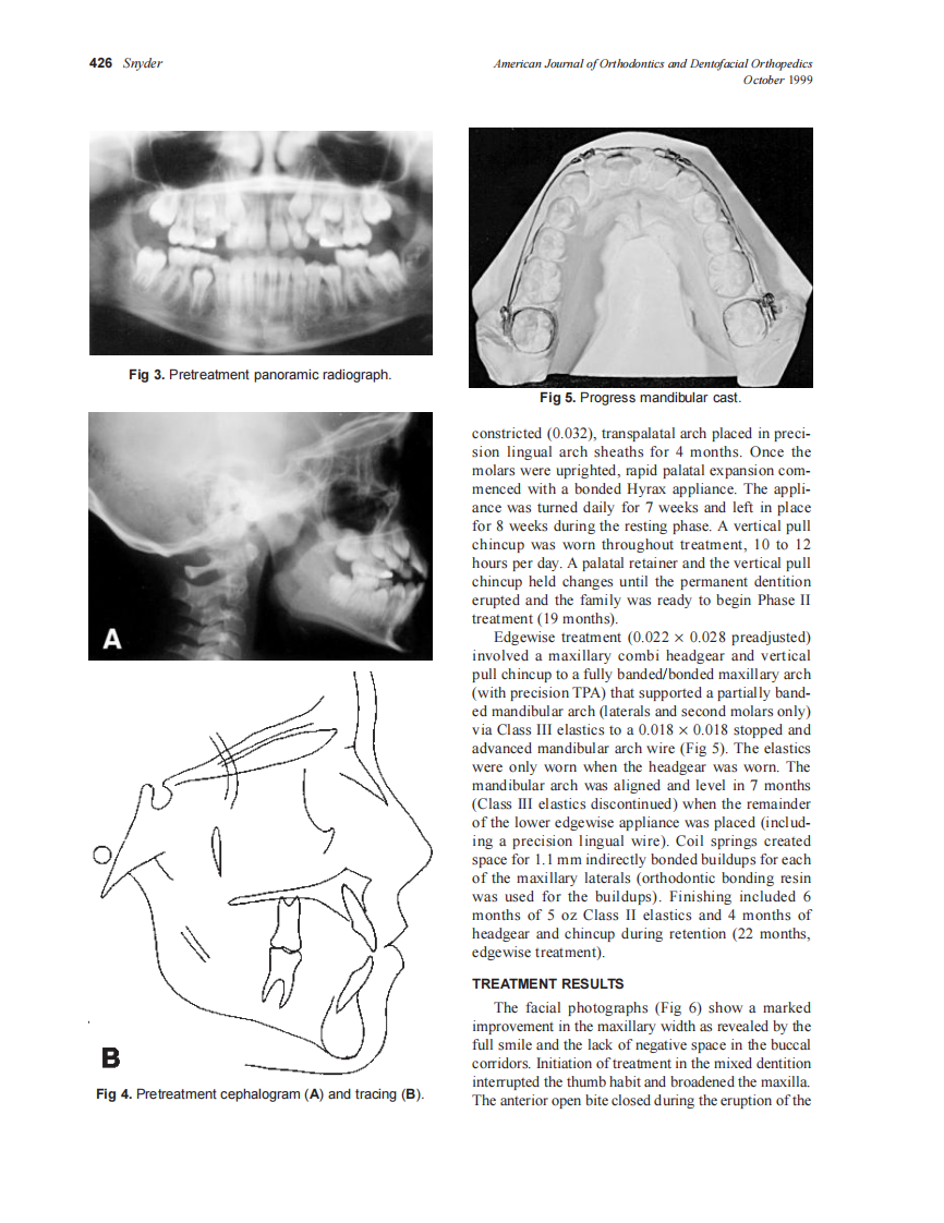 1999_116_4_424_429_Snyder_by_OrTHoTaMiNe.pdf 第3页