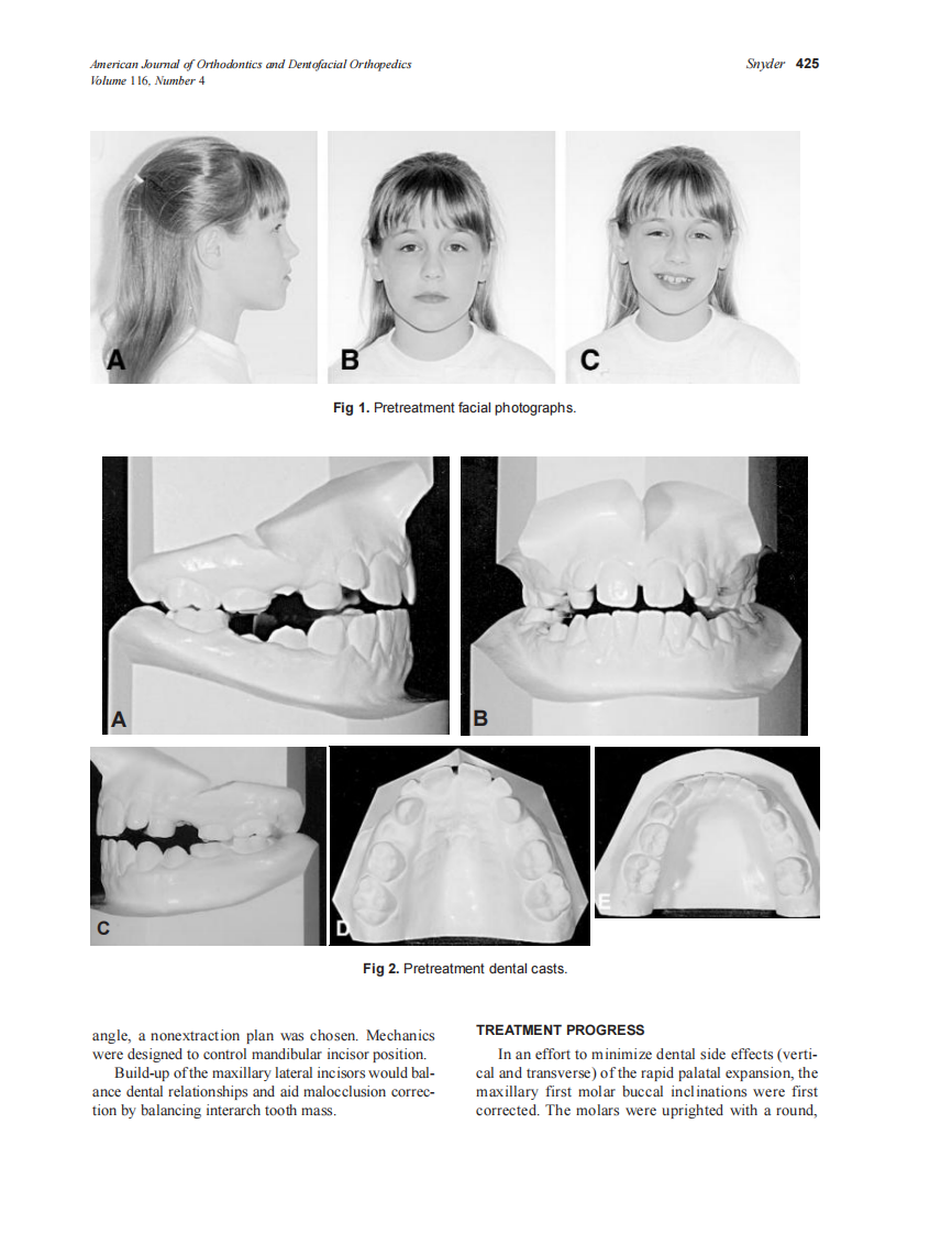 1999_116_4_424_429_Snyder_by_OrTHoTaMiNe.pdf 第2页