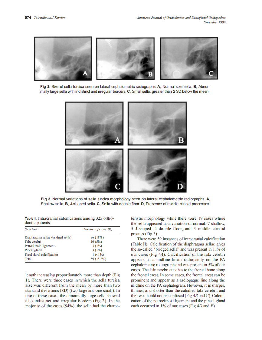 1999_sdarticle_14.pdf 第3页