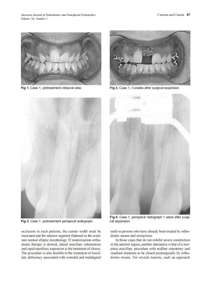 Cureton_1999_116_1_by_OrTHoTaMiNe.pdf 第2页
