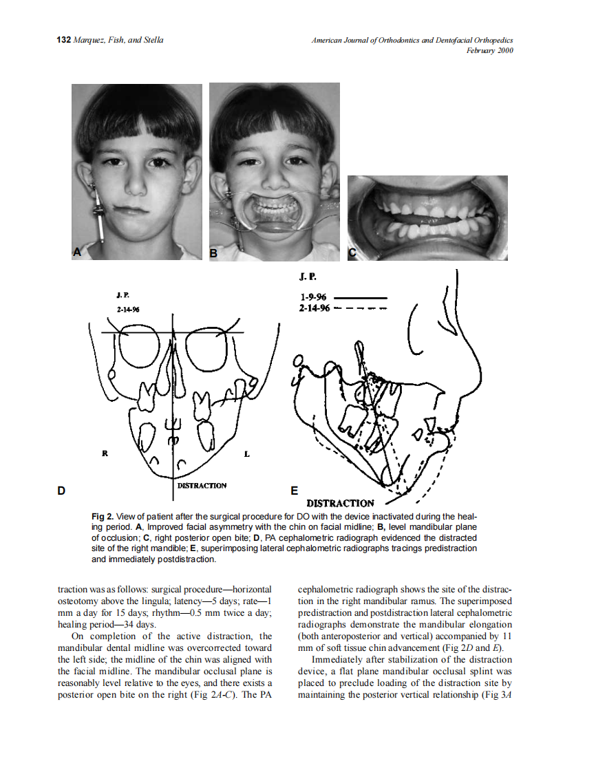 2000_117_2_130_139_Marquez.pdf 第3页