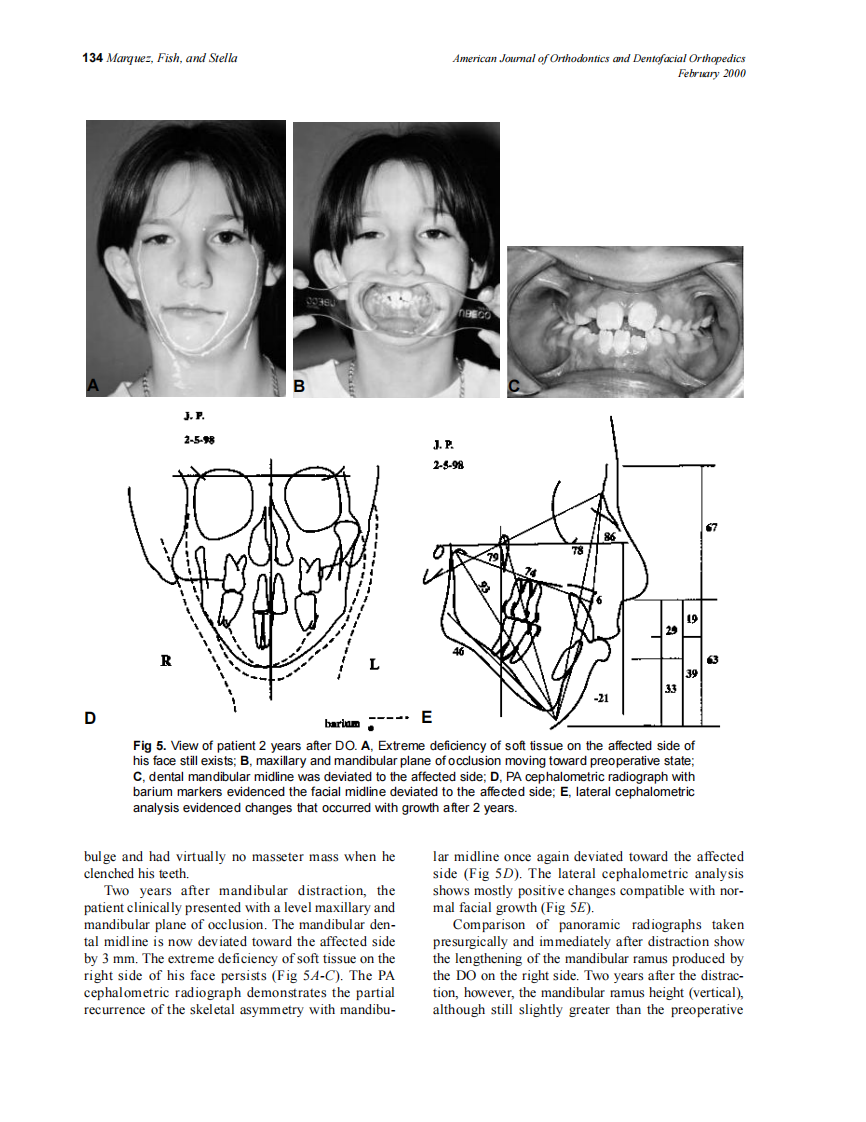 2000_117_2_130_139_Marquez.pdf 第5页