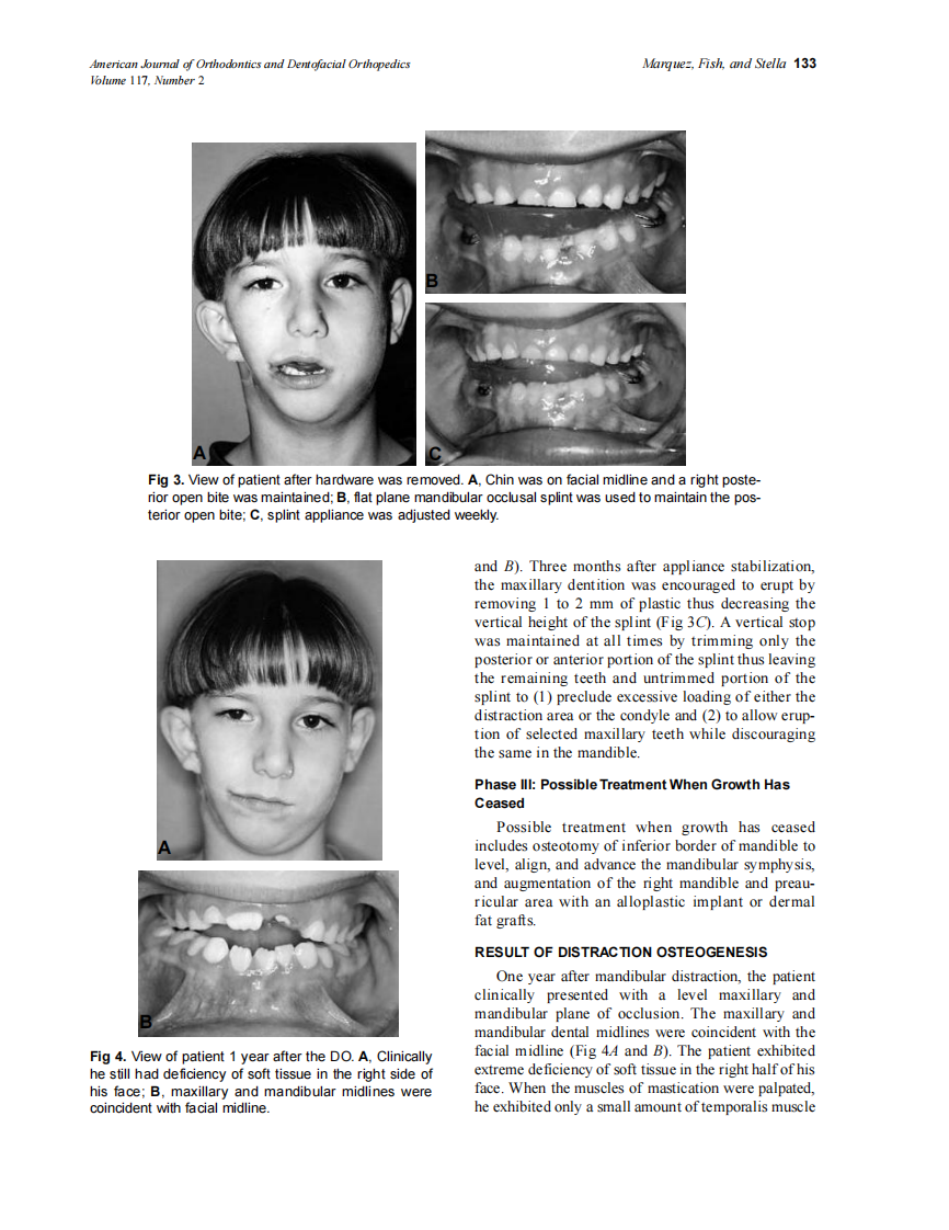 2000_117_2_130_139_Marquez.pdf 第4页