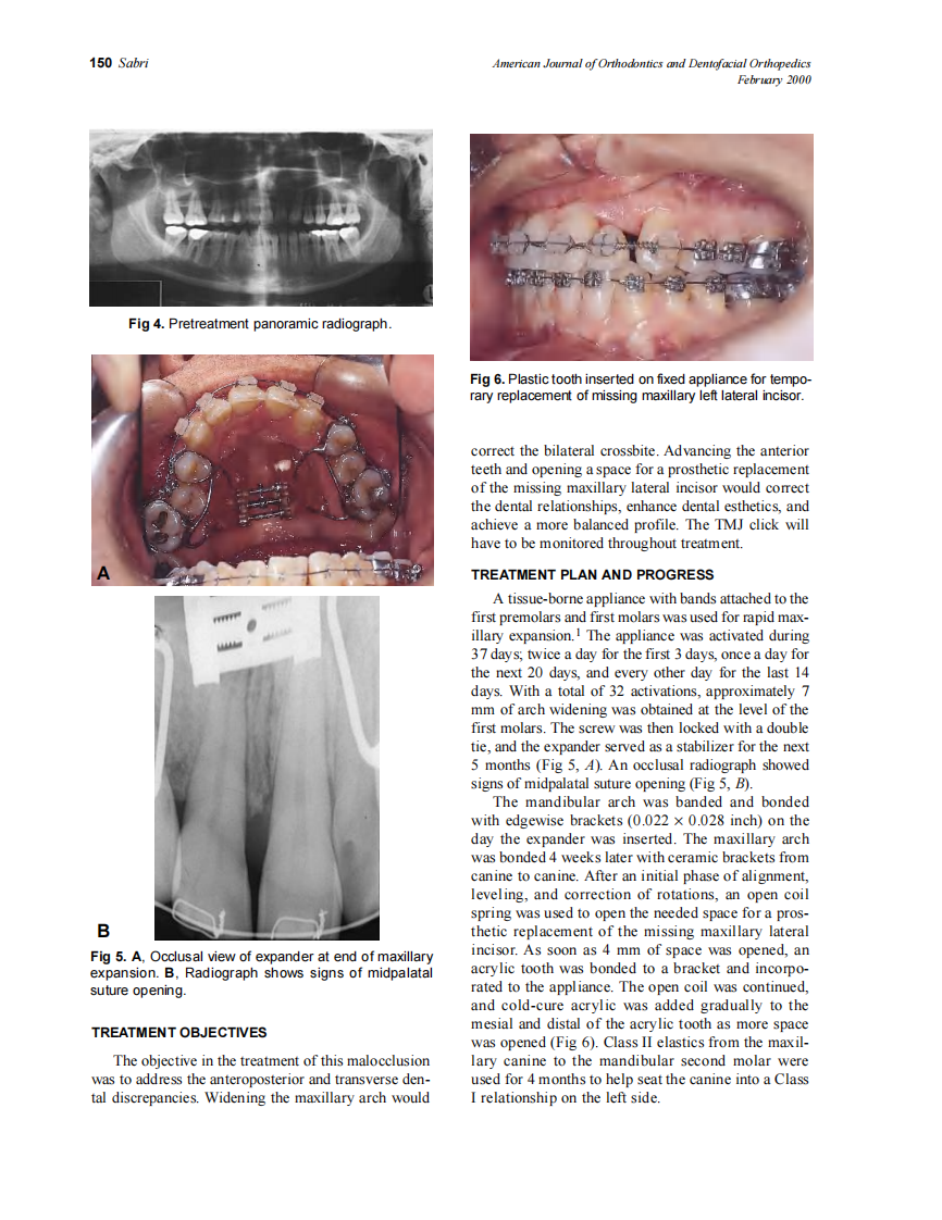 2000_117_2_148_155_Sabri.pdf 第3页