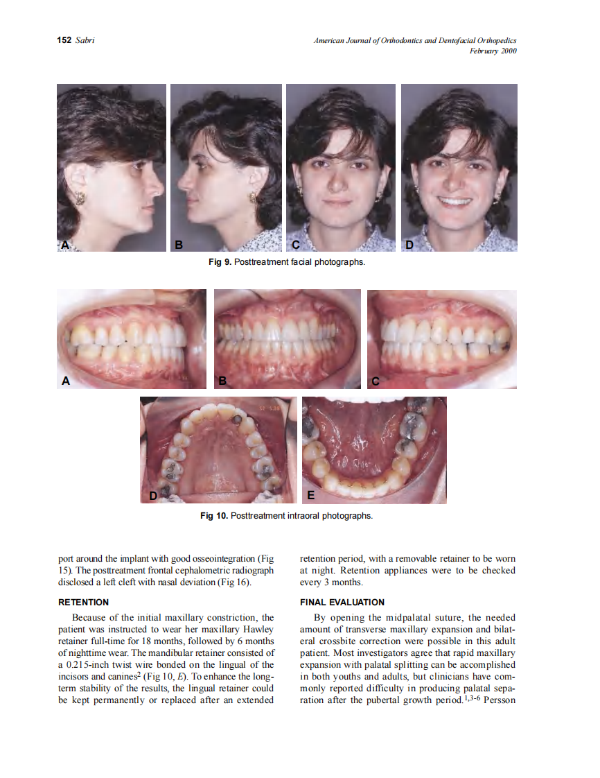 2000_117_2_148_155_Sabri.pdf 第5页
