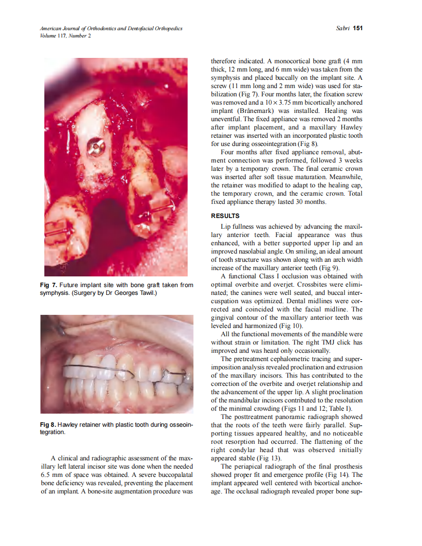 2000_117_2_148_155_Sabri.pdf 第4页