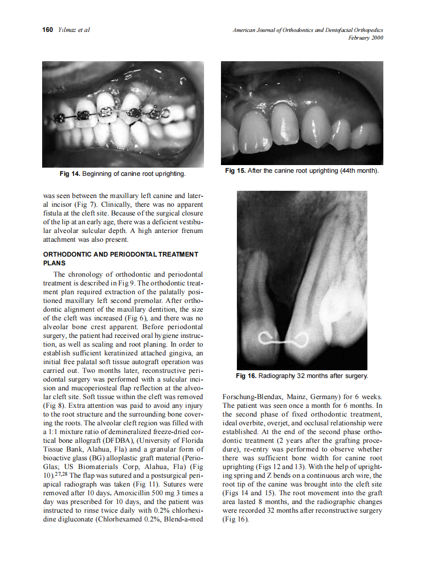 2000_117_2_156_163_Yilmaz.pdf 第5页