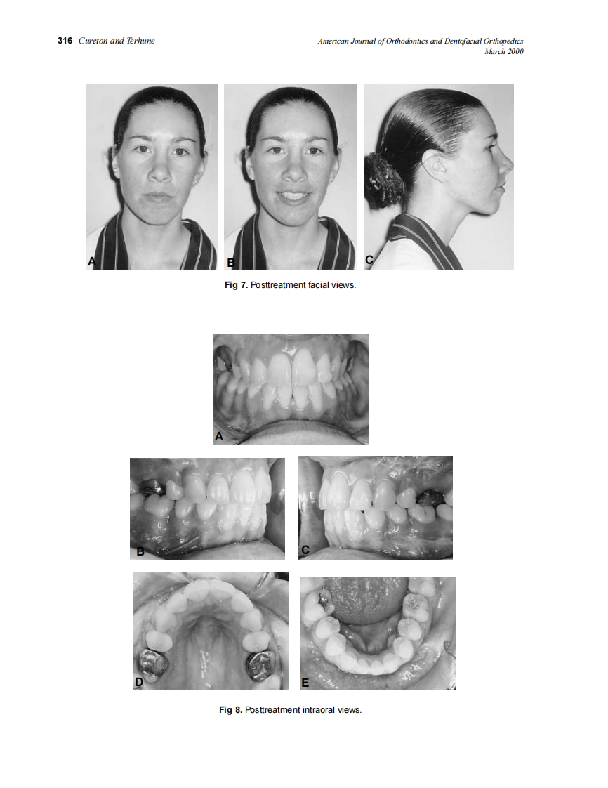 2000_117_3_312_319_Cureton.pdf 第5页