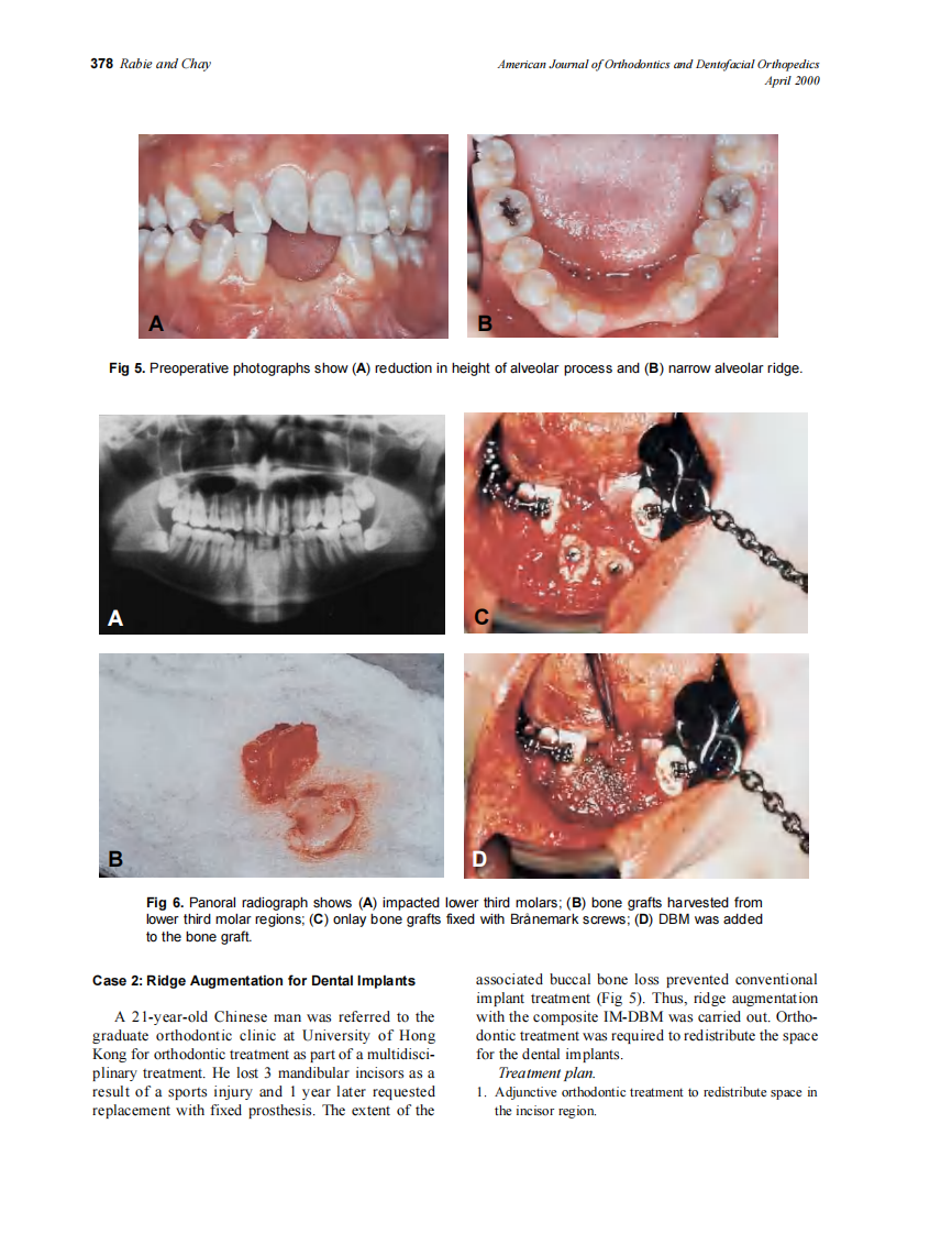 2000_117_4_375_383_Rabie.pdf 第4页