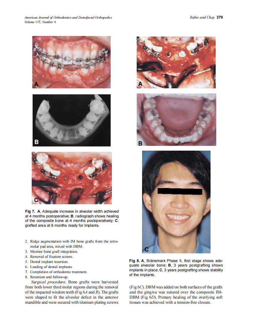 2000_117_4_375_383_Rabie.pdf 第5页