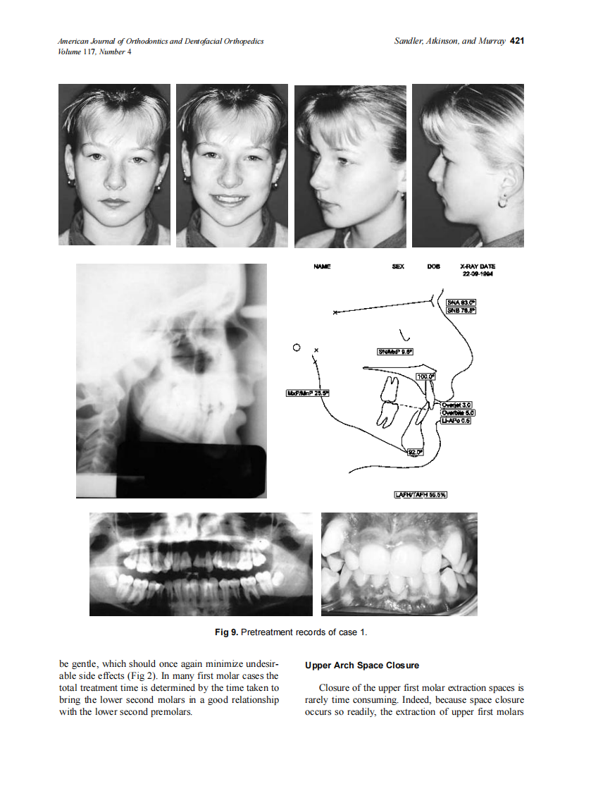 2000_117_4_418_434_Sandler.pdf 第4页