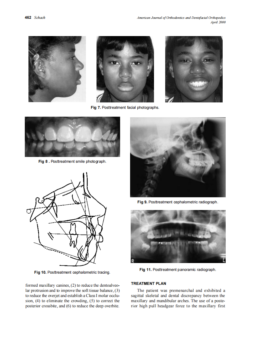 2000_117_4_459_464_Schach.pdf 第4页