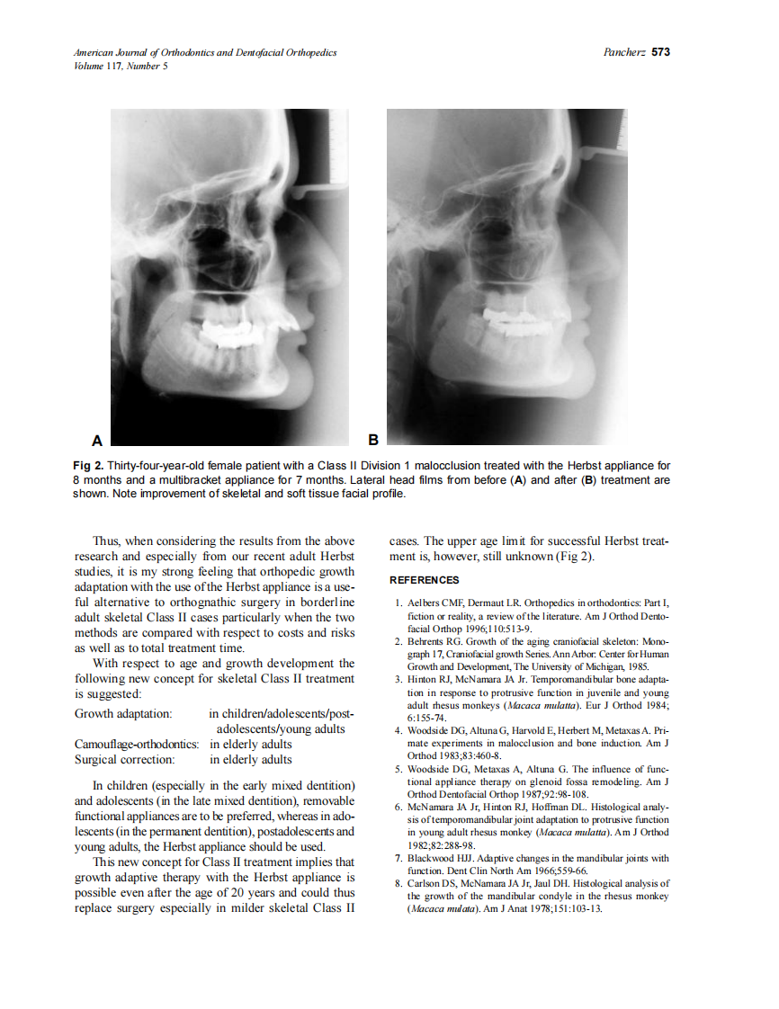 2000_117_5_571_574_Pancherz.pdf 第3页