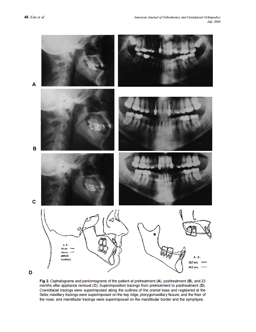 2000_118_1_43_54_Kim.pdf 第4页