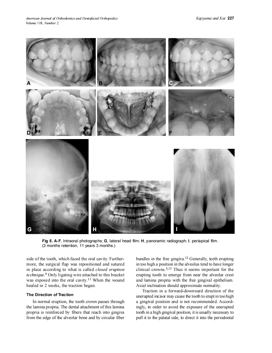 2000_118_2_224_228_Kajiyama.pdf 第4页