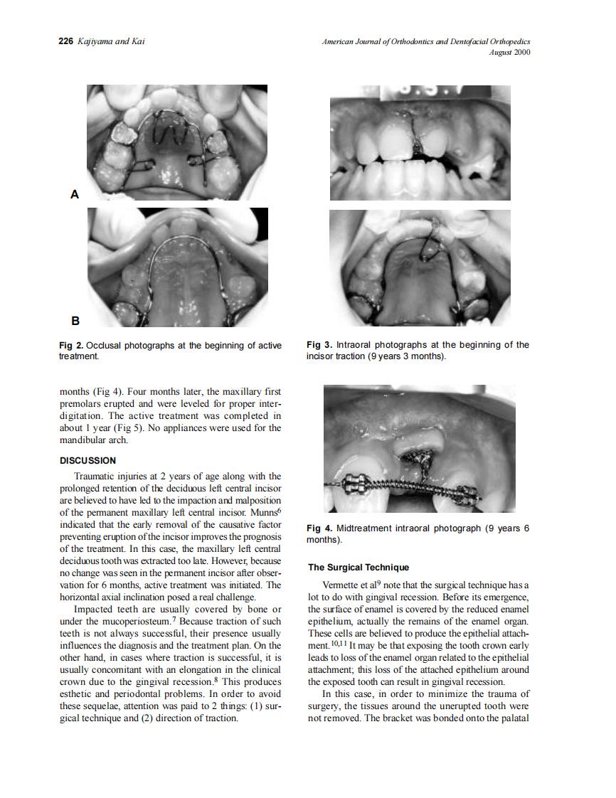 2000_118_2_224_228_Kajiyama.pdf 第3页