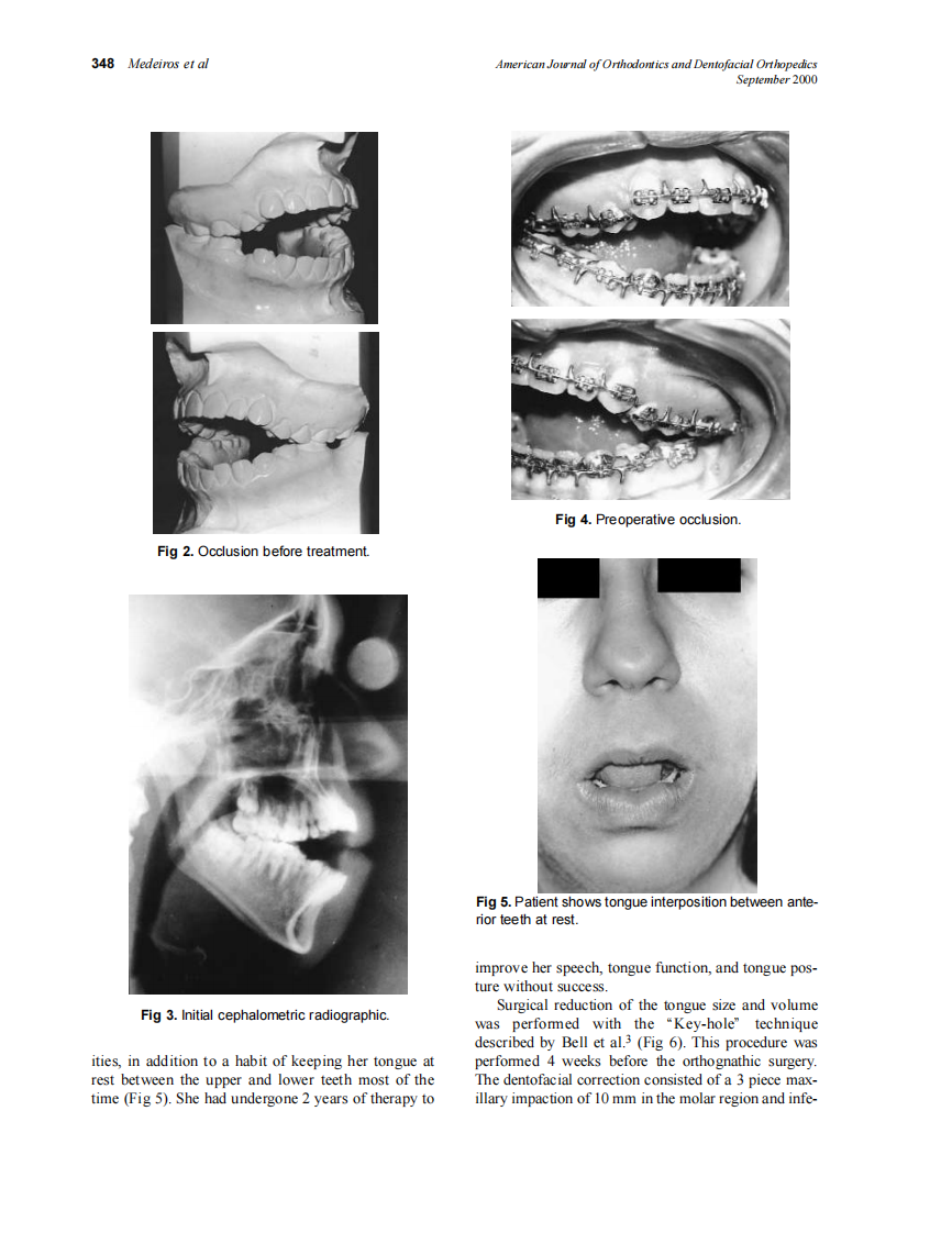 2000_118_3_347_351_Medeiros.pdf 第2页