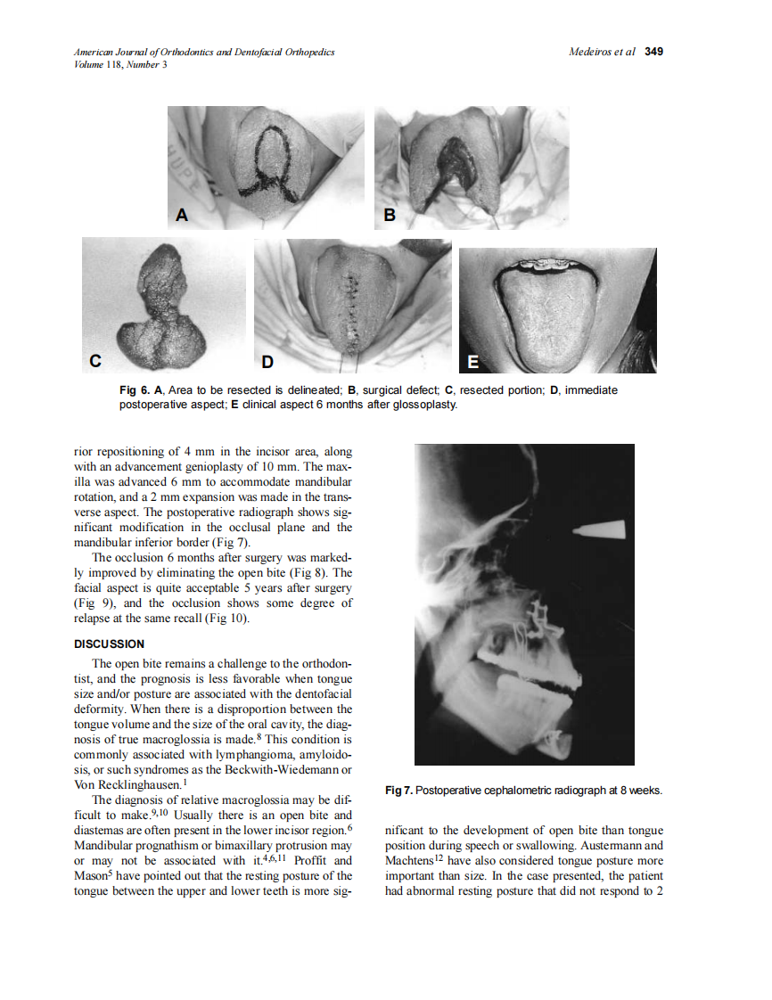 2000_118_3_347_351_Medeiros.pdf 第3页
