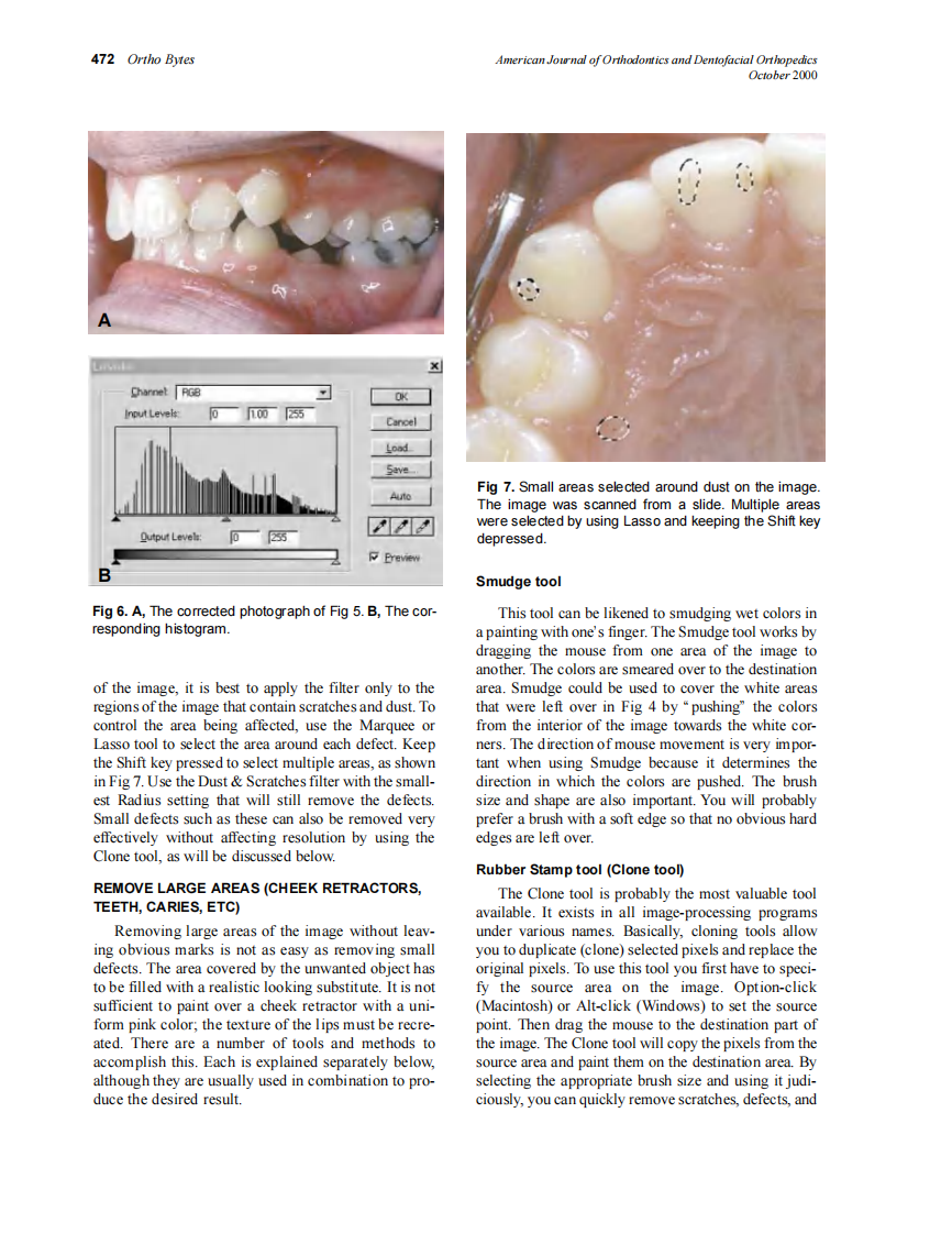 2000_118_4_469_475_Halazonetis.pdf 第4页