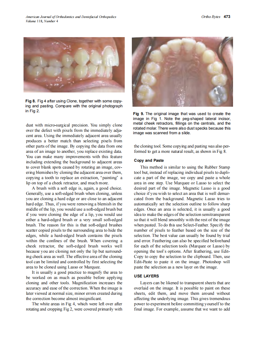 2000_118_4_469_475_Halazonetis.pdf 第5页