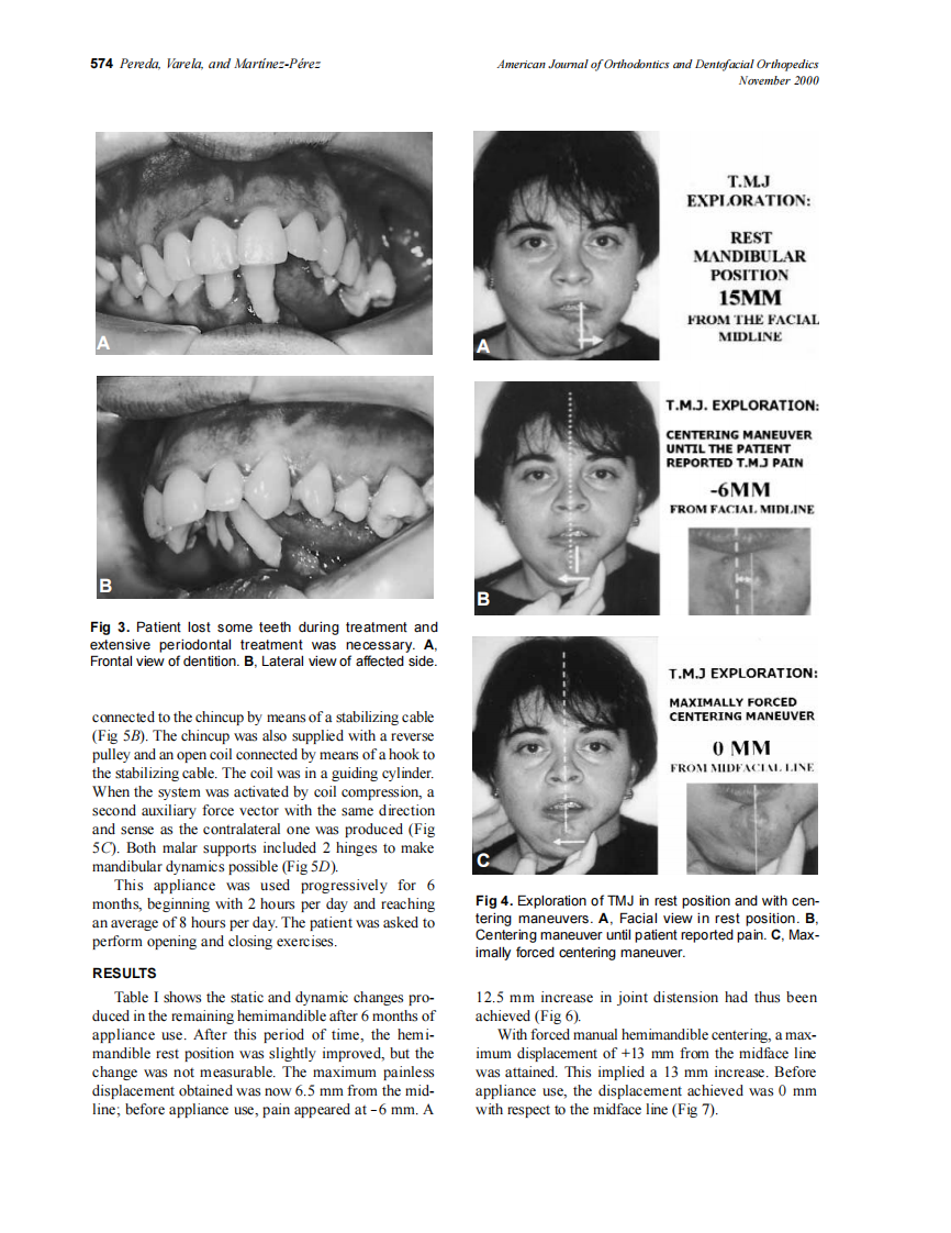 2000_118_5_572_577_Pereda.pdf 第3页