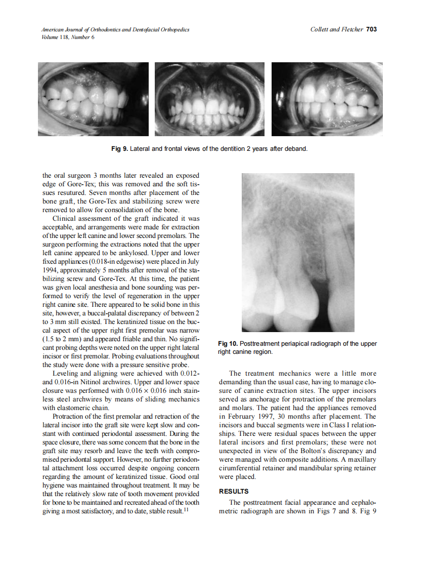 2000_118_6_699_704_Collett.pdf 第5页