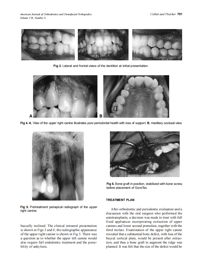 2000_118_6_699_704_Collett.pdf 第3页