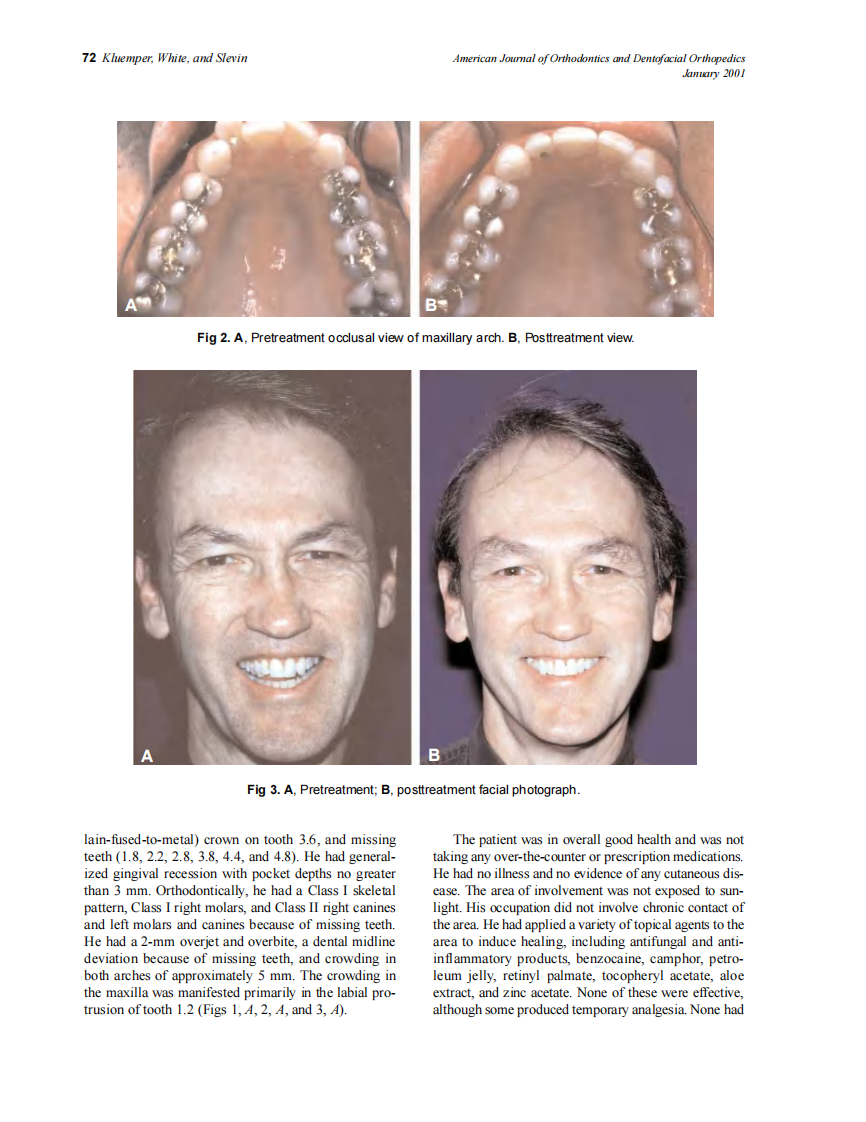 2001_119_1_71_75_Kluemper.pdf 第2页