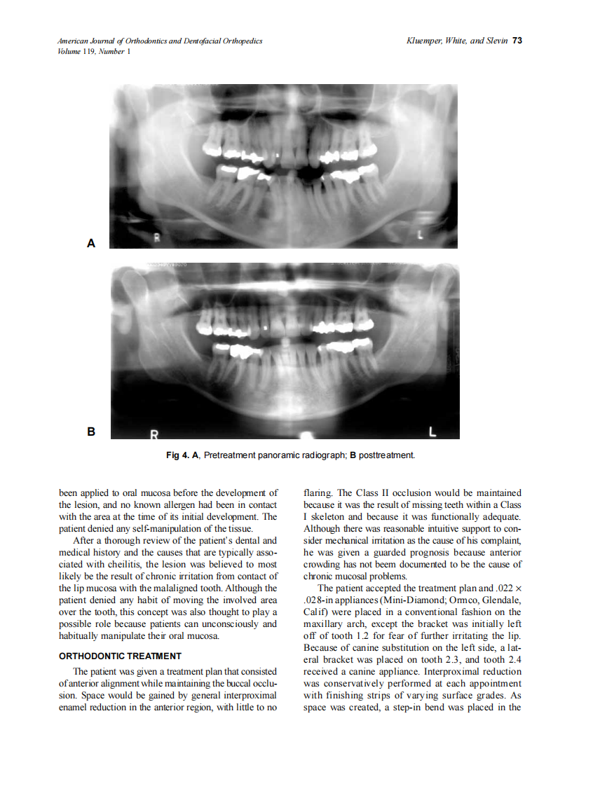 2001_119_1_71_75_Kluemper.pdf 第3页