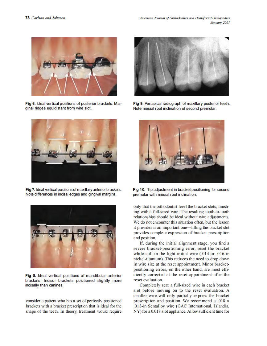 2001_119_1_76_80_Carlson.pdf 第3页