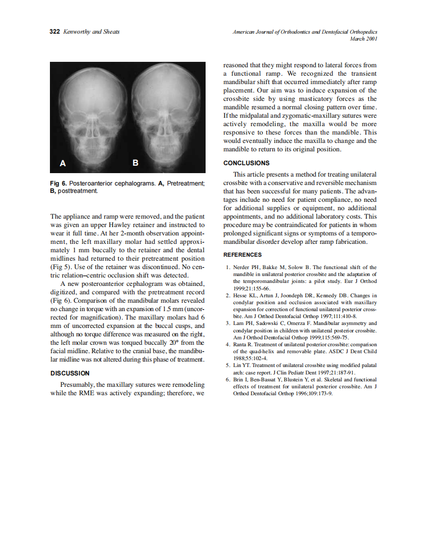2001_119_3_320_322_Kenworthy.pdf 第3页