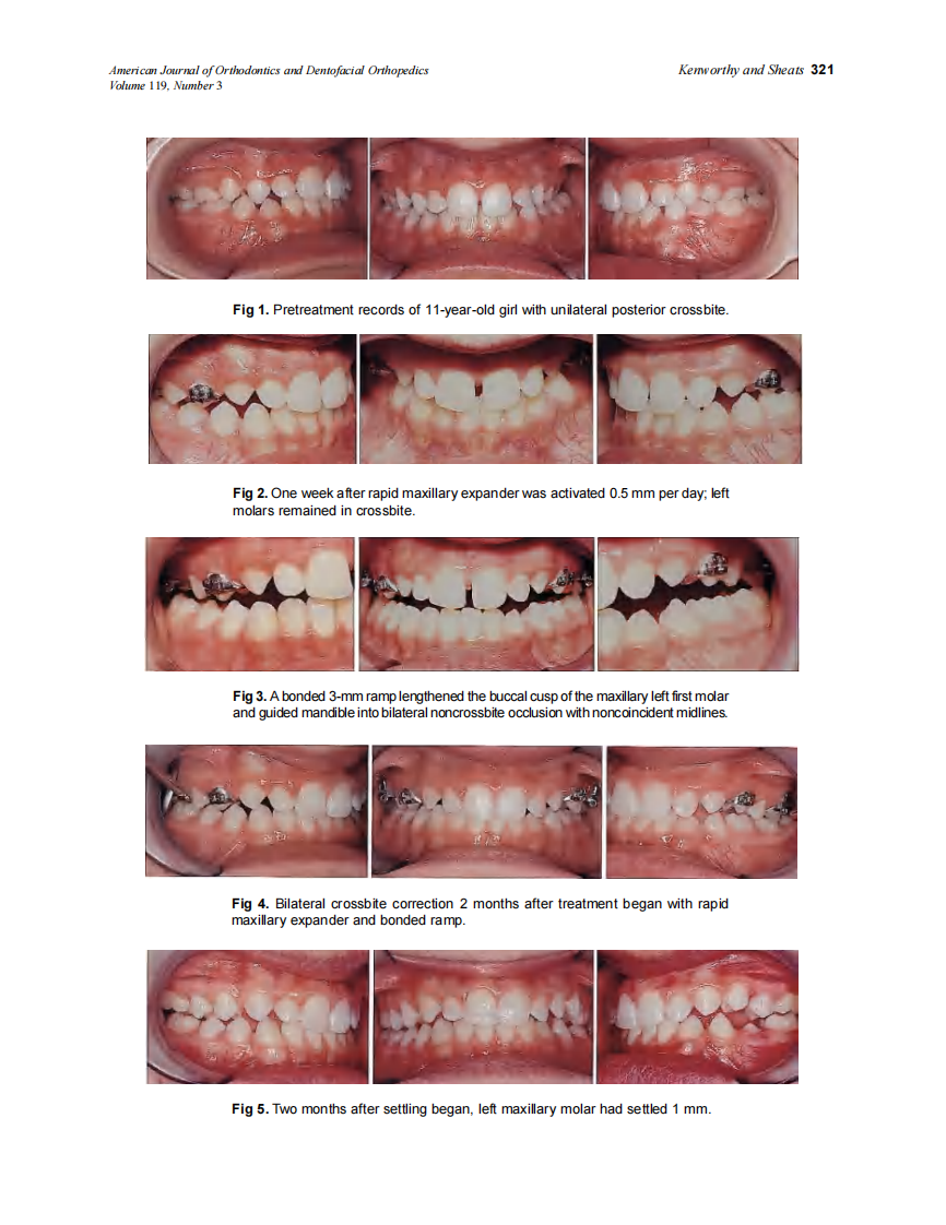 2001_119_3_320_322_Kenworthy.pdf 第2页