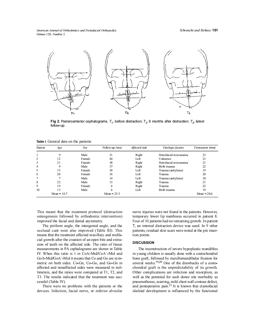 2001_120_2_149_153_Tehranchi.pdf 第3页