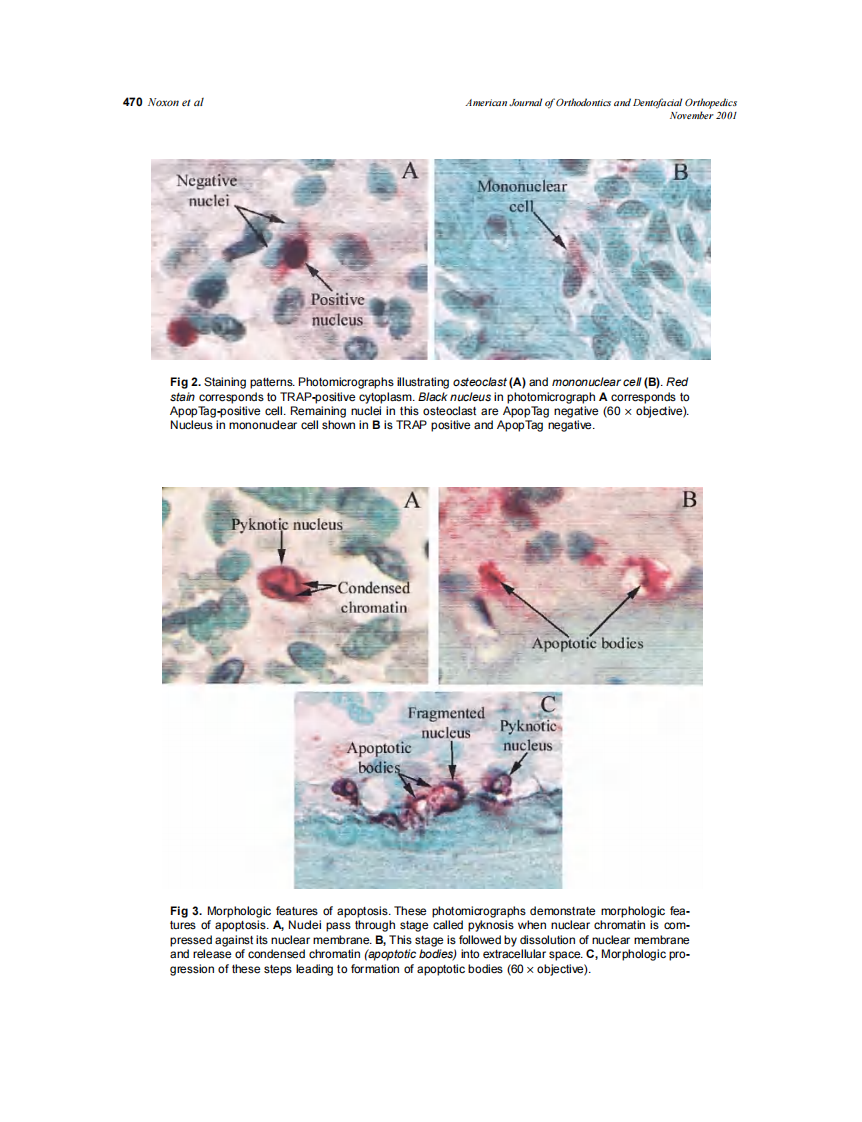 2001_120_5_466_476_Noxon.pdf 第5页