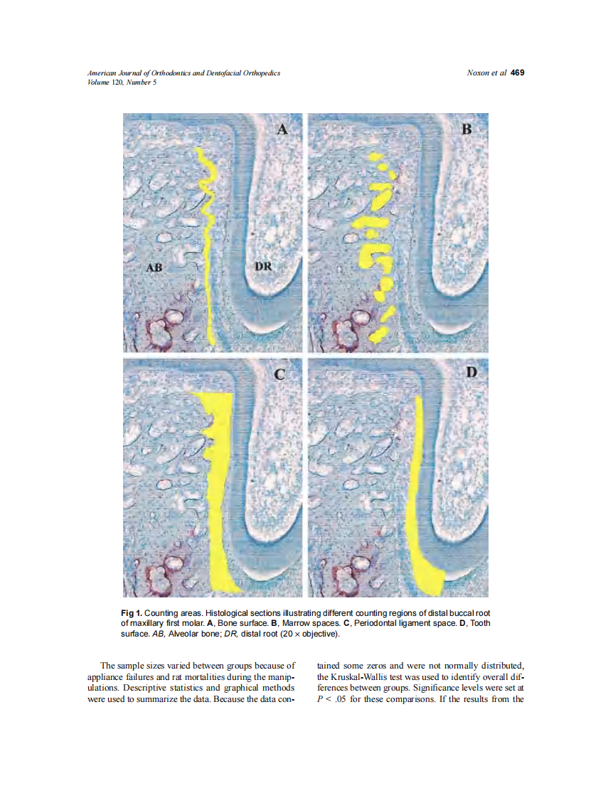 2001_120_5_466_476_Noxon.pdf 第4页