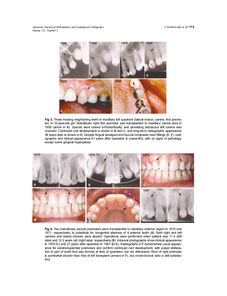 2002_121_2_110_119_Czochrowska.pdf 第4页