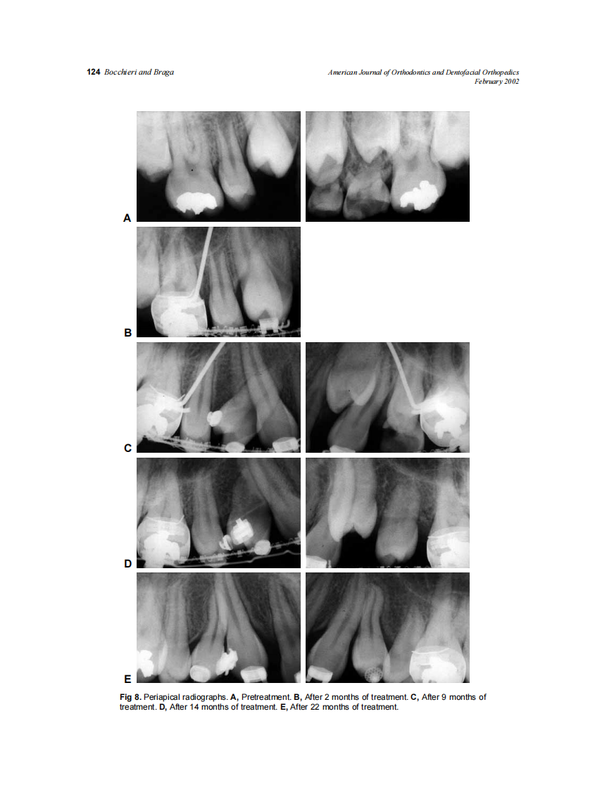 2002_121_2_120_128_Bocchieri.pdf 第5页
