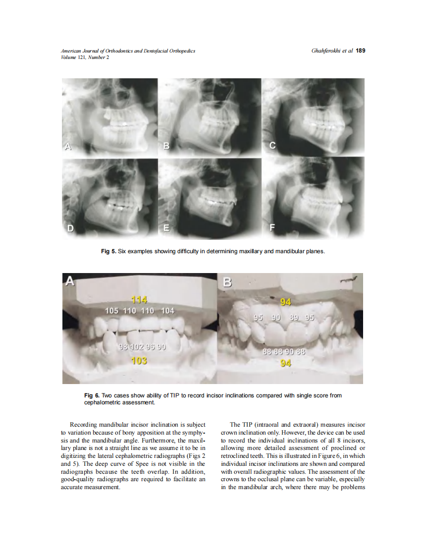 2002_121_2_185_191_Ghahferokhi.pdf 第5页