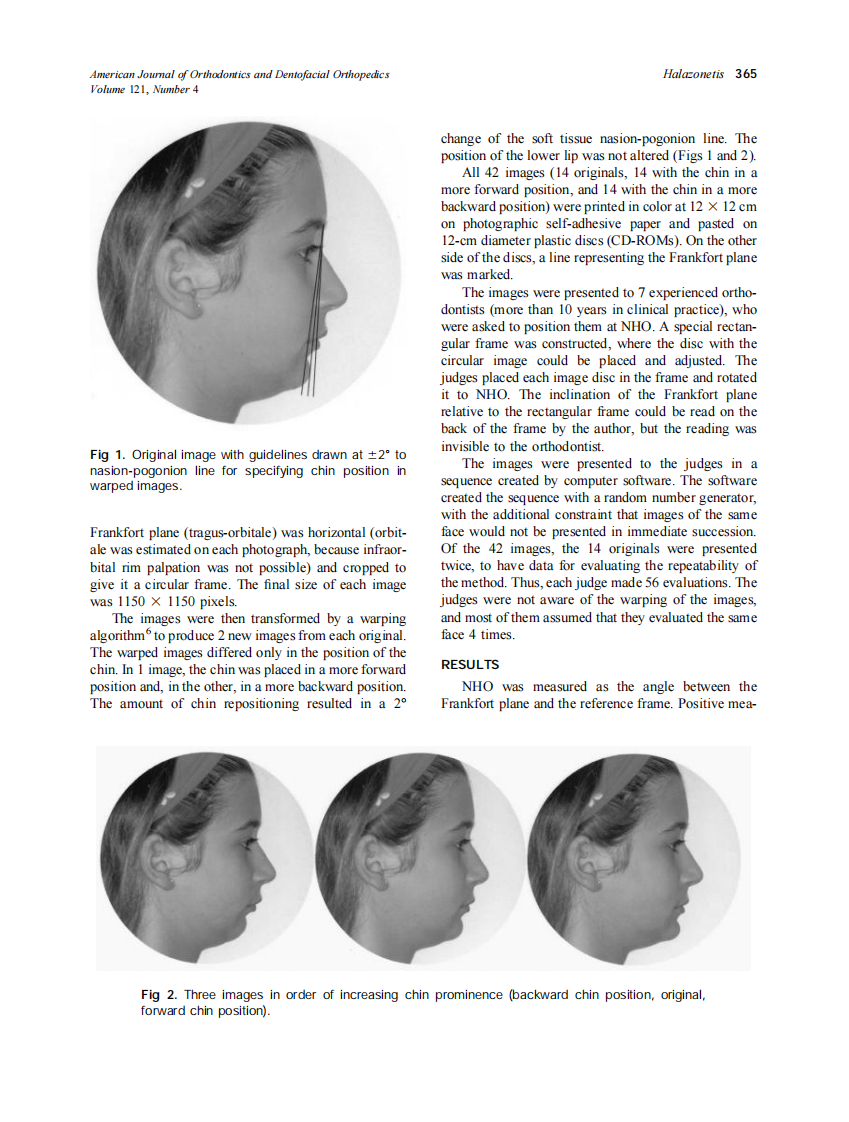 2002_121_4_364_368_Halazonetis.pdf 第2页