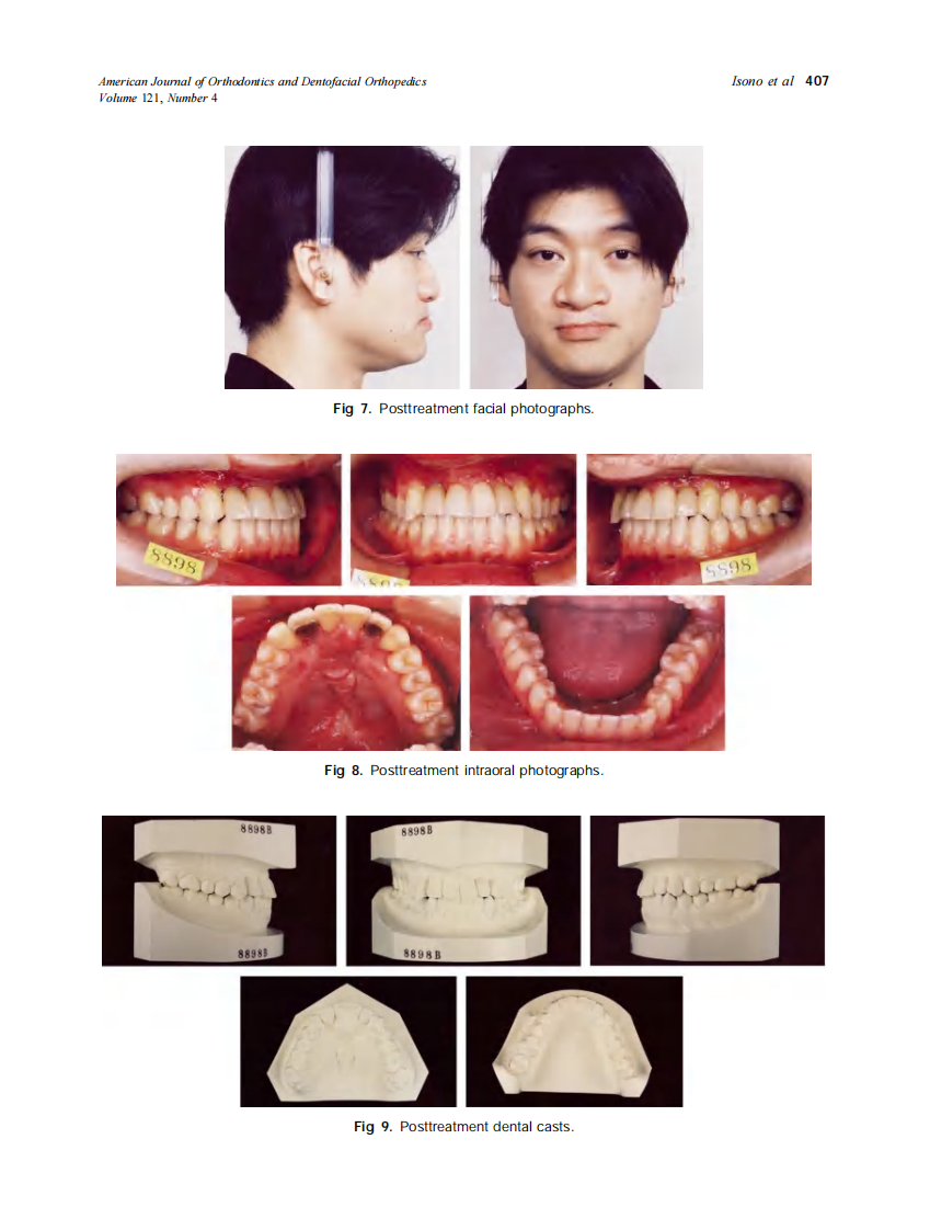 2002_121_4_403_410_Isono.pdf 第5页