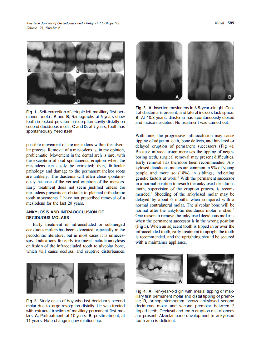 2002_121_6_588_591_Kurol.pdf 第2页