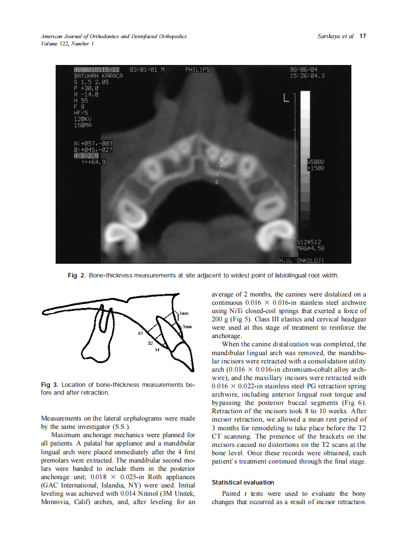 2002_122_1_15_26_Sarikaya.pdf 第3页