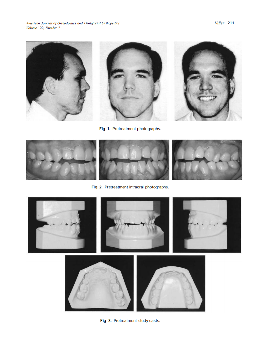 2002_122_2_210_216_Hiller.pdf 第2页