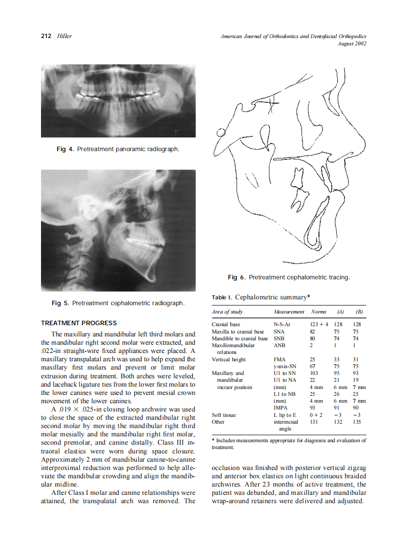 2002_122_2_210_216_Hiller.pdf 第3页