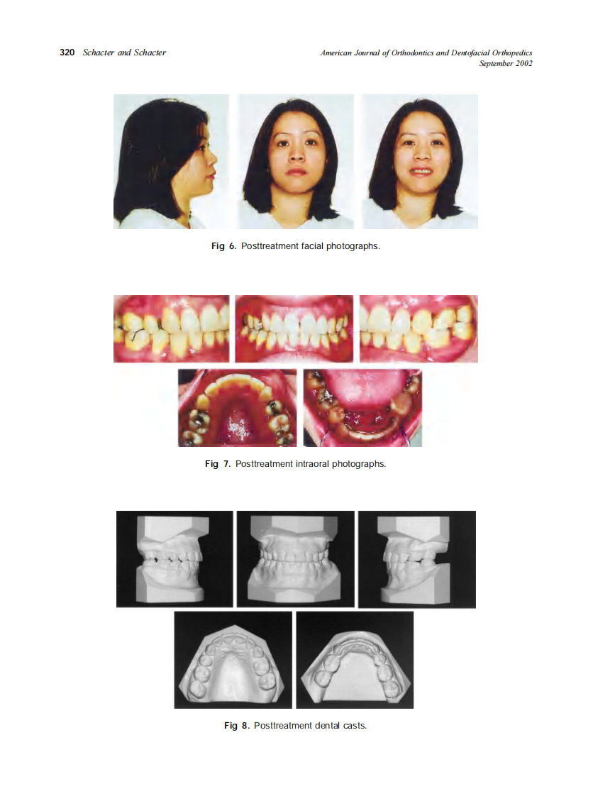 2002_122_3_317_322_Schacter.pdf 第4页