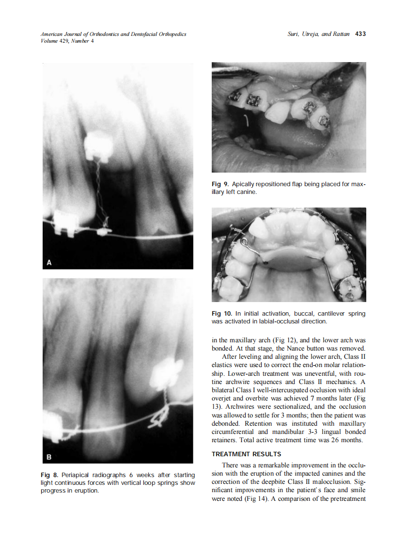 2002_122_4_429_437_Suri.pdf 第5页