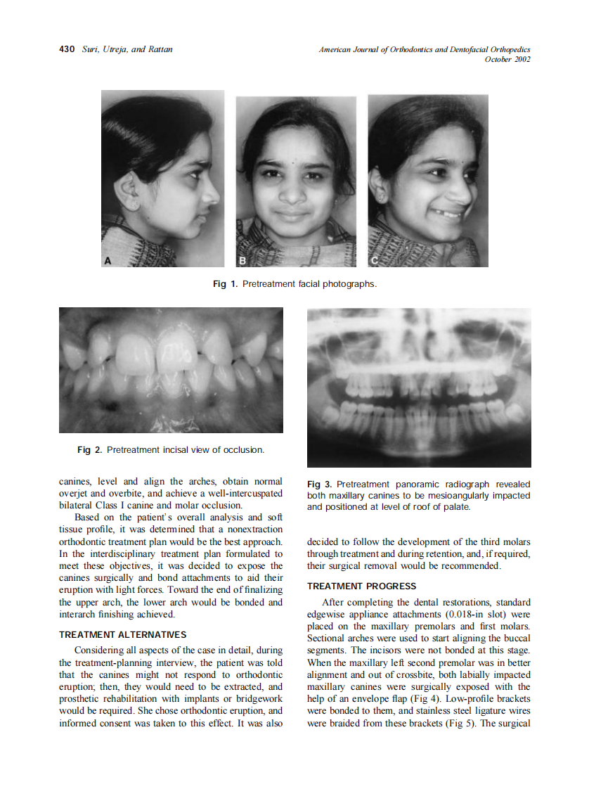 2002_122_4_429_437_Suri.pdf 第2页