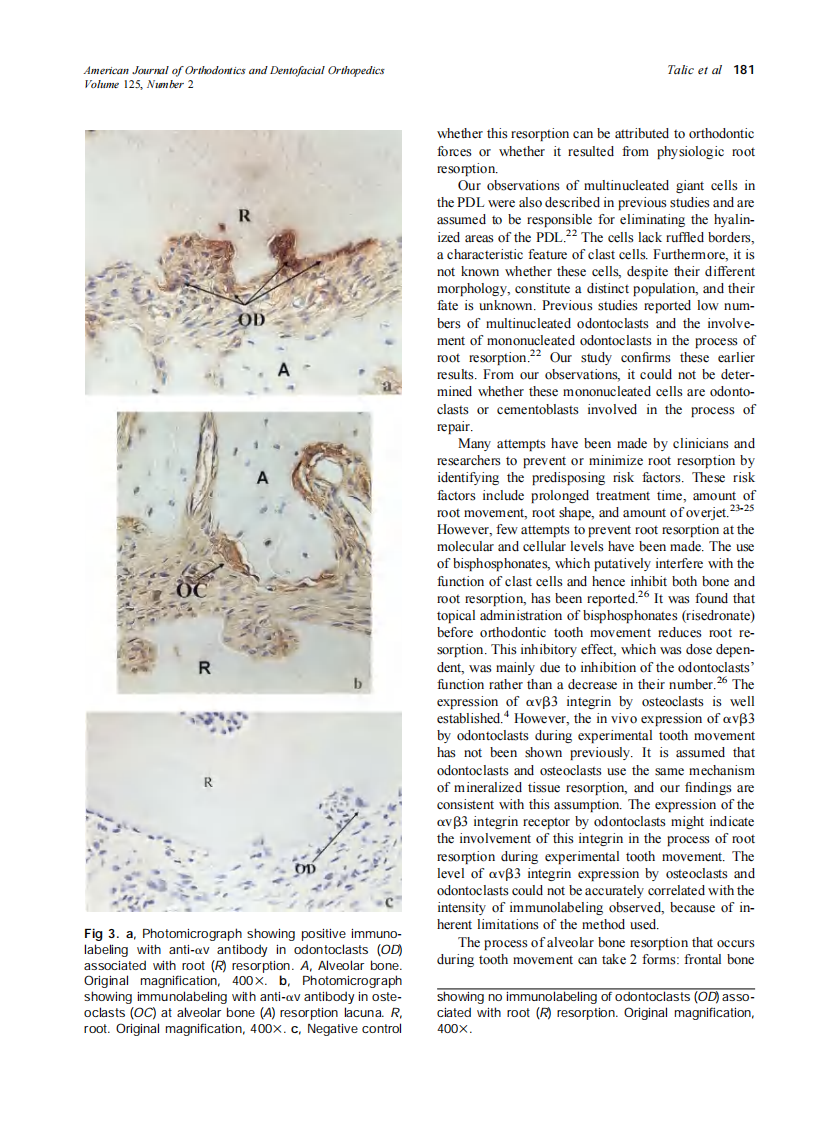 2004_125_2_178_184_Talic.pdf 第4页