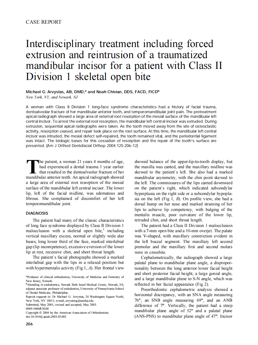 2004_125_2_206_212_Arvystas.pdf 第1页